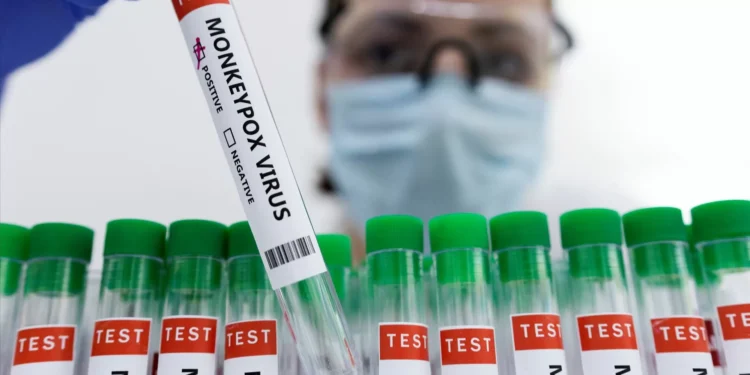 Monkeypox. OMS reúne comité de emergência na quarta-feira para avaliar epidemia