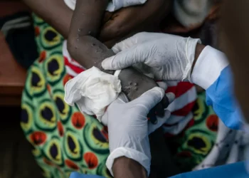 OMS: Casos de mpox na República Democrática do Congo estão a estabilizar
