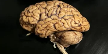 Autorizado fármaco para atrasar deficit cognitivo em doentes com Alzheimer