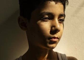 Guerra em Gaza. Foto do Ano do World Press Photo mostra rapaz palestiniano mutilado