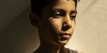 Guerra em Gaza. Foto do Ano do World Press Photo mostra rapaz palestiniano mutilado