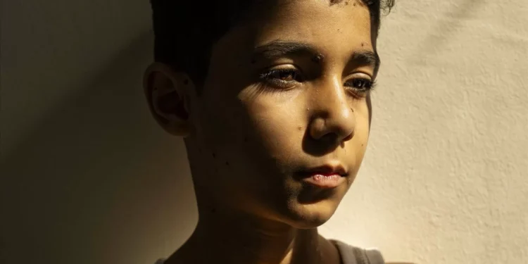 Guerra em Gaza. Foto do Ano do World Press Photo mostra rapaz palestiniano mutilado