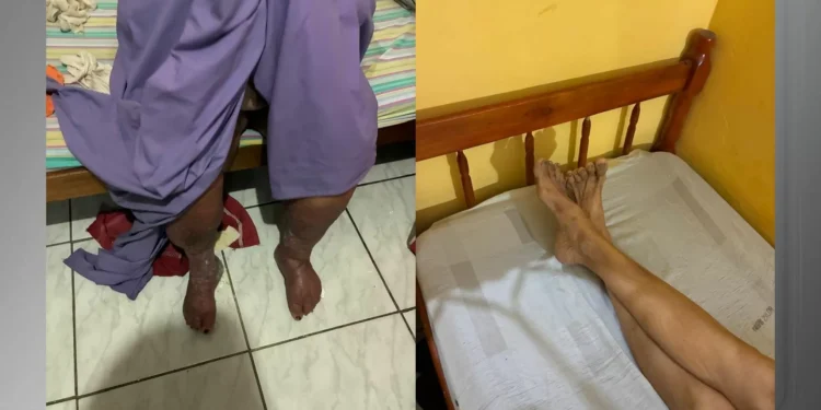 Asilo é interditado por maus-tratos contra idosos em Campo Grande (RJ)