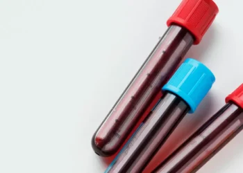 EUA aprovam uso de exame sanguíneo para detectar Alzheimer