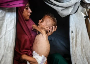 OMS alerta para níveis alarmantes da subnutrição na Faixa de Gaza