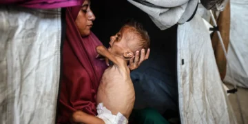 OMS alerta para níveis alarmantes da subnutrição na Faixa de Gaza