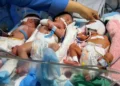 “É um desastre”. Em Gaza, bebés prematuros lutam para sobreviver em incubadoras sobrelotadas