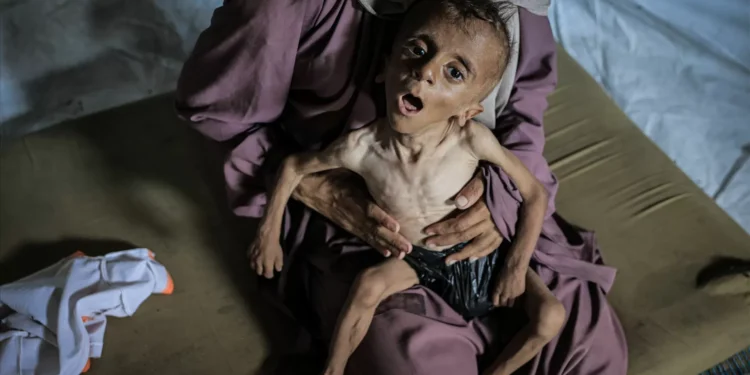 “Fome é ferramenta do exército israelita para destruir a população palestiniana”