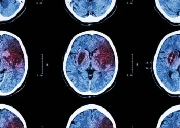 Neurocientistas revelam primeiro mapa cerebral completo durante tomada de decisão