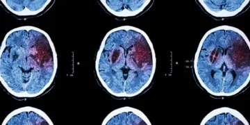Neurocientistas revelam primeiro mapa cerebral completo durante tomada de decisão