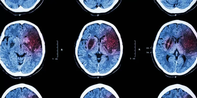 Neurocientistas revelam primeiro mapa cerebral completo durante tomada de decisão