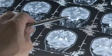 ​Adolescência prolonga-se até aos 30 anos, conclui novo estudo sobre o cérebro