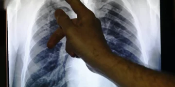 Gripenet volta permitir à população participar na vigilância das infeções respiratórias