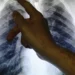 Gripenet volta permitir à população participar na vigilância das infeções respiratórias